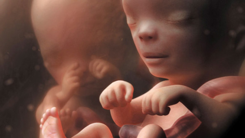 LE MYSTERE DES JUMEAUX